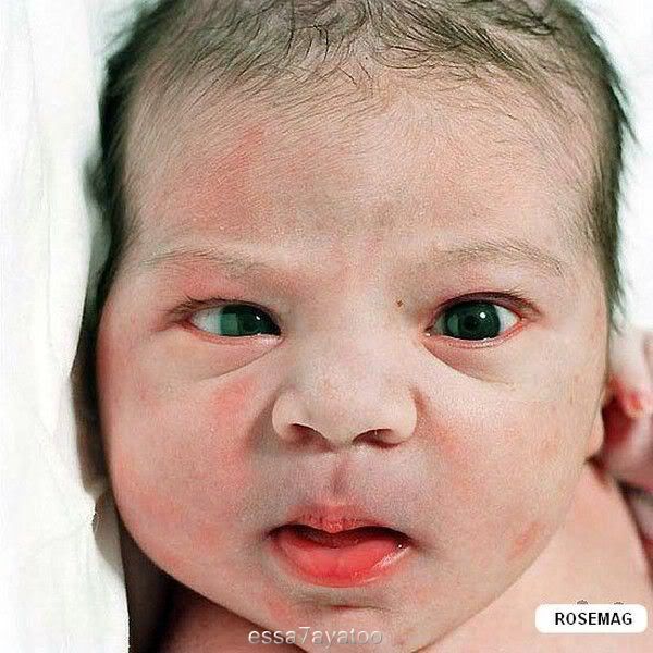 صور اطفال  , بعد الولاده ب لحظات , اطفال جميلة 2017 baby9-1.jpg